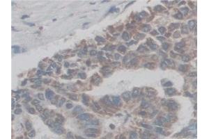 Immunohistochemistry (IHC) image for anti-ATP Synthase, H+ Transporting, Mitochondrial F0 Complex, Subunit F6 (ATP5J) (AA 1-108) antibody (ABIN7441733)