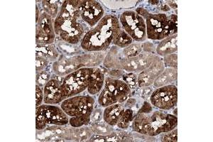Immunohistochemical staining of human kidney with C20orf196 polyclonal antibody  shows strong cytoplasmic positivity in tubular cells at 1:50-1:200 dilution. (C20ORF196 抗体)