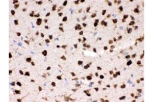 IHC testing of FFPE mouse brain with HuD antibody. (ELAV (Embryonic Lethal, Abnormal Vision, Drosophila)-Like (ELAVL) 抗体)
