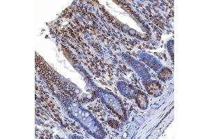 IHC analysis of TRMT61A using anti-TRMT61A antibody (ABIN7599220).