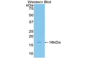 Western Blotting (WB) image for anti-Galectin 7 (LGALS7) (AA 1-128) antibody (ABIN1172746)