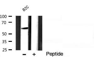Western Blotting (WB) image for anti-V-Akt Murine Thymoma Viral Oncogene Homolog 1 (AKT1) (pSer124) antibody (ABIN6256119)