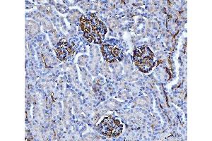 IHC analysis of CD147/Emmprin using anti-CD147/Emmprin antibody (ABIN7599999).