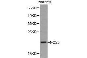Western Blotting (WB) image for anti-Nitric Oxide Synthase 3 (Endothelial Cell) (NOS3) antibody (ABIN1873922) (ENOS 抗体)