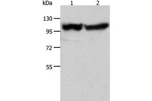 Western Blot analysis of Human fetal muscle tissue and hela cell using ACTN3 Polyclonal Antibody at dilution of 1:400 (ACTN3 抗体)