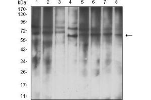 Western Blotting (WB) image for anti-Insulin-Like Growth Factor 2 mRNA Binding Protein 3 (IGF2BP3) (AA 430-579) antibody (ABIN7193580)