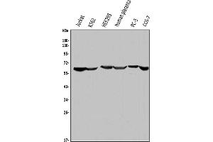Western blot analysis of ME2 using anti-ME2 antibody (ABIN7600967).