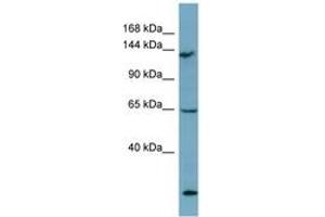 Image no. 1 for anti-LATS, Large Tumor Suppressor, Homolog 1 (Drosophila) (LATS1) (AA 971-1020) antibody (ABIN6741908)