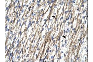 Image no. 1 for anti-RNA Binding Motif Protein 10 (RBM10) (AA 79-128) antibody (ABIN202953) (RBM10 抗体  (AA 79-128))