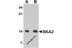 Western Blotting (WB) image for anti-Spindle and Kinetochore-Associated Protein 2 (FAM33A) (N-Term) antibody (ABIN1031572) (FAM33A 抗体  (N-Term))
