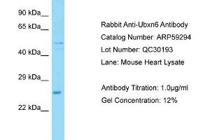 Western Blotting (WB) image for anti-UBX Domain Protein 6 (UBXN6) (Middle Region) antibody (ABIN2788011)