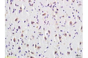 Immunohistochemistry (IHC) image for anti-Tumor Necrosis Factor Receptor Superfamily, Member 9 (TNFRSF9) (AA 101-200) antibody (ABIN740445)