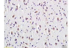 Formalin-fixed and paraffin embedded rat brain tissue labeled with Anti-CD137/TNFRSF9 Polyclonal Antibody, Unconjugated (ABIN740445) at 1:600 followed by conjugation to the secondary antibody