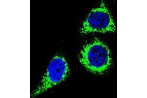 Confocal immunofluorescent analysis of BCL10 Antibody (N-term) (Cat#AP50354PU-N) with Hela cell followed by Alexa Fluor 488-conjugated goat anti-rabbit lgG (green). (BCL10 抗体  (N-Term))