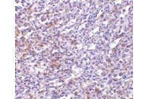 Immunohistochemistry of TCCR in human spleen tissue with this product at 10 μg/ml. (IL27 Receptor alpha 抗体  (N-Term))