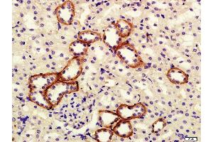 Paraformaldehyde-fixed, paraffin embedded rat kidney tissue, Antigen retrieval by boiling in sodium citrate buffer(pH6) for 15min, Block endogenous peroxidase by 3% hydrogen peroxide for 30 minutes, Blocking buffer (normal goat serum) at 37°C for 20min, Antibody incubation with Rabbit Anti-klotho Polyclonal Antibody, Unconjugated  at 1:400 overnight at 4°C, followed by a conjugated secondary and DAB staining (Klotho 抗体  (AA 401-500))
