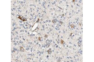 ABIN6266962 at 1/100 staining human brain tissue sections by IHC-P. (ALDOC 抗体  (C-Term))