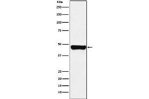 Western blot analysis of RCC1 expression in A431 cell lysate.