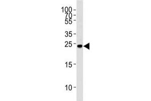 Western blot analysis of lysate from Ramos cell line using GRB2 antibody at 1:1000. (GRB2 抗体  (AA 187-216))