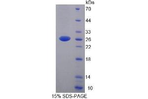SDS-PAGE analysis of Human YAF2 Protein. (YAF2 蛋白)
