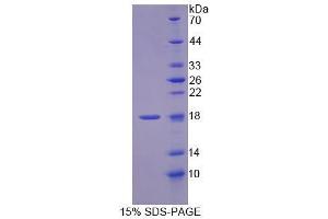 SDS-PAGE analysis of Rat MCEE Protein.