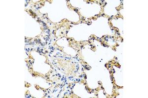 Immunohistochemistry of paraffin-embedded rat lung using PIP antibody (ABIN5973796) at dilution of 1/100 (40x lens). (PIP 抗体)