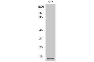 Western Blotting (WB) image for anti-Cystatin B (Stefin B) (CSTB) (Internal Region) antibody (ABIN3174683) (CSTB 抗体  (Internal Region))