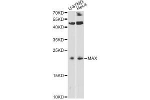 Western blot analysis of extracts of various cell lines, using MAX antibody. (MAX 抗体)