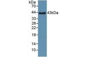 Detection of Recombinant SPD, Human using Polyclonal Antibody to Surfactant Associated Protein D (SPD) (SFTPD 抗体  (AA 21-375))