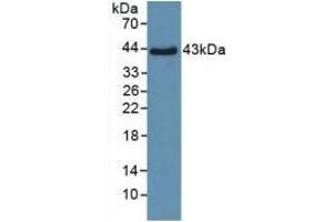 Detection of Recombinant SPD, Human using Polyclonal Antibody to Surfactant Associated Protein D (SPD) (SFTPD 抗体  (AA 21-375))