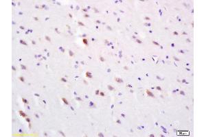 Formalin-fixed and paraffin embedded rat brain labeled with Anti-SLC30A3/ZNT3 Polyclonal Antibody, Unconjugated (ABIN1386246) at 1:200 followed by conjugation to the secondary antibody and DAB staining (Slc30a3 抗体  (AA 20-75))