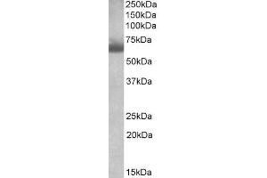 ABIN571287 (1µg/ml) staining of Human Testis lysate (35µg protein in RIPA buffer). (BBS4 抗体  (AA 33-46))