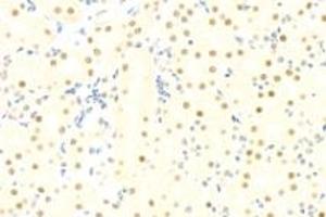 Immunohistochemistry (Paraffin-embedded Sections) (IHC (p)) image for anti-SIN3 homolog A, transcription regulator (SIN3A) antibody (ABIN7075609)