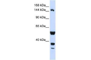 WB Suggested Anti-ABI3BP Antibody Titration:  0. (ABI3BP 抗体  (N-Term))