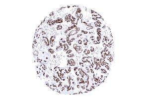 Strong CD34 immunostaining of blood vesels in a mature placenta
