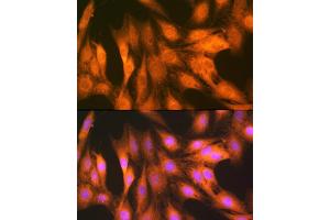 Immunofluorescence analysis of C6 cells using F/UBD Rabbit mAb (ABIN7271134) at dilution of 1:100 (40x lens). (UBD 抗体)
