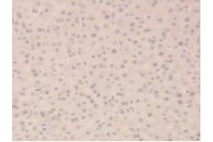 Immunohistochemistry (IHC) image for anti-Sirtuin 6 (SIRT6) (AA 1-334) antibody (ABIN7437191)