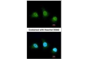 Immunofluorescence (IF) image for anti-Peptidyl Arginine Deiminase, Type IV (PADI4) (Center) antibody (ABIN2856939)