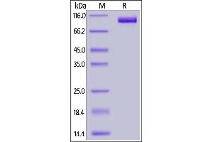 SDS-PAGE (SDS) image for Folate Hydrolase (Prostate-Specific Membrane Antigen) 1 (FOLH1) (AA 44-750) (Active) protein (His tag,FITC) (ABIN6973205)