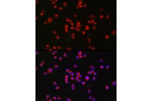 Immunofluorescence analysis of Neuro-2a cells using nNOS Rabbit mAb (ABIN1680436, ABIN1680435, ABIN7101483 and ABIN7101484) at dilution of 1:100 (40x lens). (NOS1 抗体)