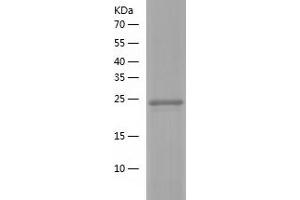 GPR114 Protein (AA 22-250) (His tag)