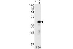 Image no. 1 for anti-SRY (Sex Determining Region Y)-Box 2 (SOX2) antibody (ABIN357439) (SOX2 抗体)