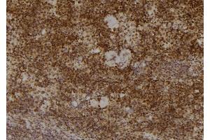 ABIN6277231 at 1/100 staining Mouse spleen tissue by IHC-P. (PSMA2 抗体  (Internal Region))