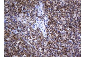 Image no. 2 for anti-NADH Dehydrogenase (Ubiquinone) 1 beta Subcomplex, 10, 22kDa (NDUFB10) antibody (ABIN1499672) (NDUFB10 抗体)