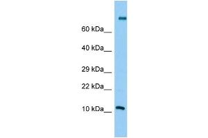 Host: Rabbit Target Name: PLA2G2C Sample Type: Jurkat Whole Cell lysates Antibody Dilution: 1. (PLA2G2C 抗体  (Middle Region))
