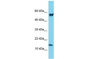Host: Rabbit Target Name: Arpc5 Sample Type: Mouse Small Intestine lysates Antibody Dilution: 1. (ARPC5 抗体  (N-Term))