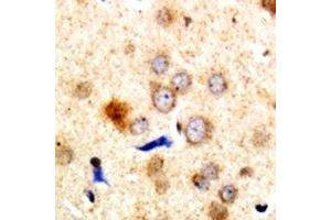 Immunohistochemical analysis of Dematin staining in human brain formalin fixed paraffin embedded tissue section. (Dematin 抗体  (C-Term))