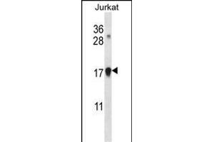 CDKN1A Antibody (C-term) (ABIN657391 and ABIN2846432) western blot analysis in Jurkat cell line lysates (35 μg/lane). (p21 抗体  (C-Term))