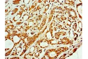 Immunohistochemistry (IHC) image for anti-ADP-Ribosylation Factor GTPase Activating Protein 3 (ARFGAP3) (AA 217-516) antibody (ABIN7143462)