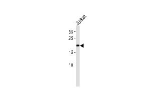 MGMT Antibody (C-term) (ABIN391514 and ABIN2841475) western blot analysis in Jurkat cell line lysates (35 μg/lane). (MGMT 抗体  (C-Term))